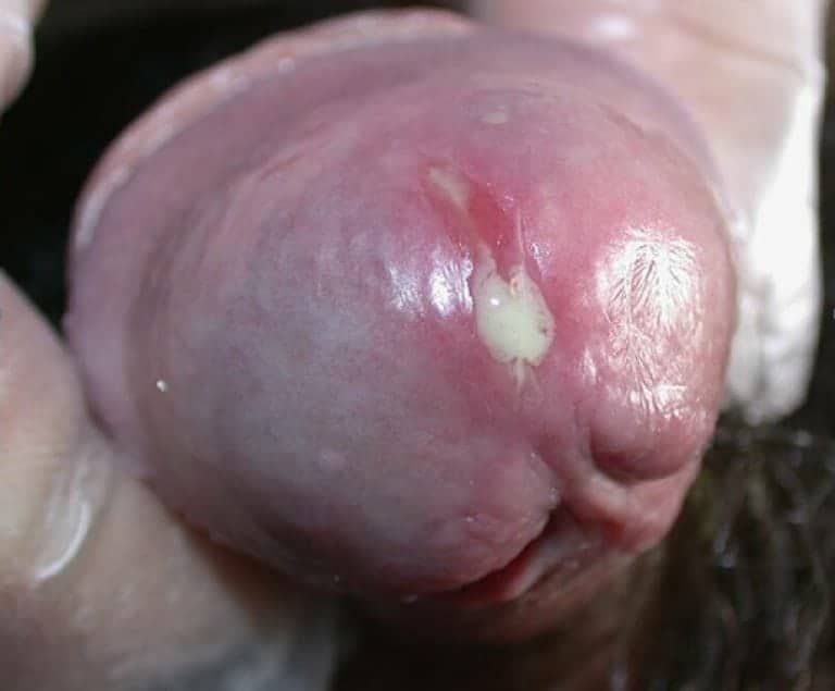 Niệu đạo là một ống dài nối từ bàng quang ra lỗ tiểu (lỗ sáo) để đưa nước tiểu ra bên ngoài.