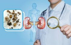 siêu âm sỏi thận