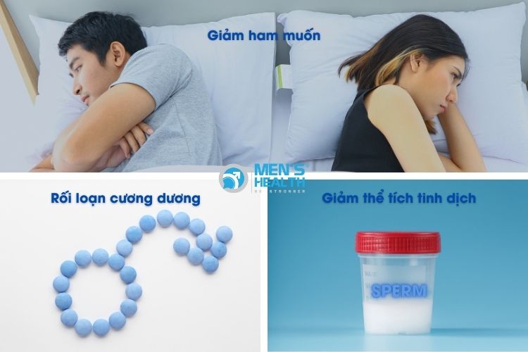 Một số tác dụng phụ của thuốc 5ARI chủ yếu về vấn đề tình dục