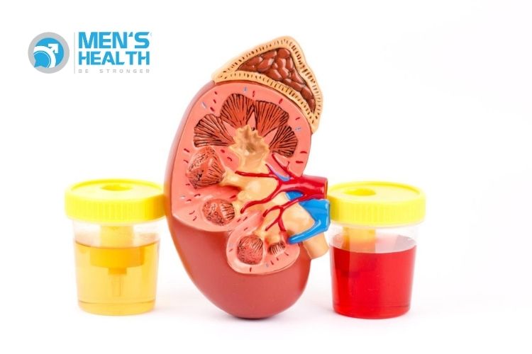 Nhóm thuốc dutasteride làm giảm nguy cơ tiểu máu, bí tiểu cấp và phẫu thuật