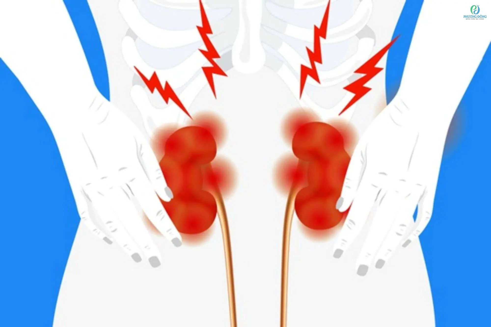 Đau Lưng Có Phải Do Thận Yếu?